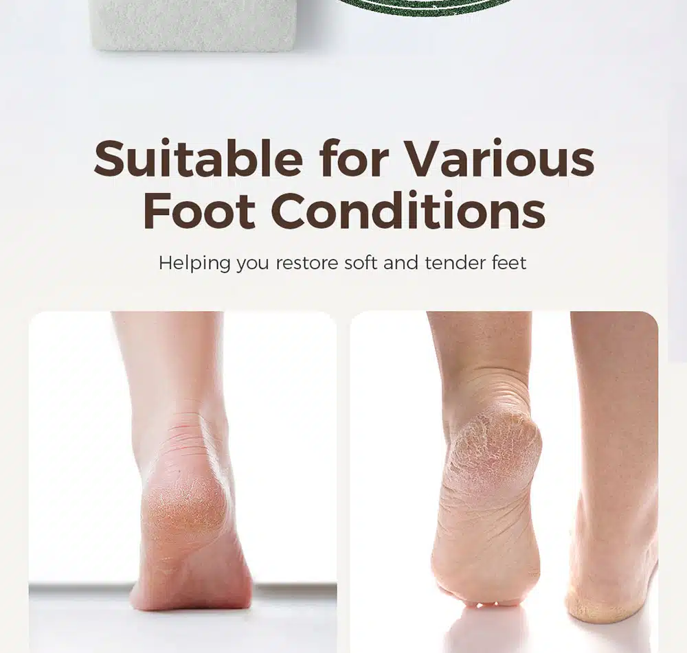 Pumiclean FC250 W 4 x 2.8 x 1.6 White Pumice Foot Scrubber For Exfoliating Foot Skin detail 10
